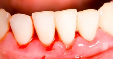 plaquetas bajas causas